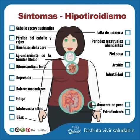 sintomas de hipotireoidismo